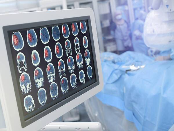 Neurosurgery