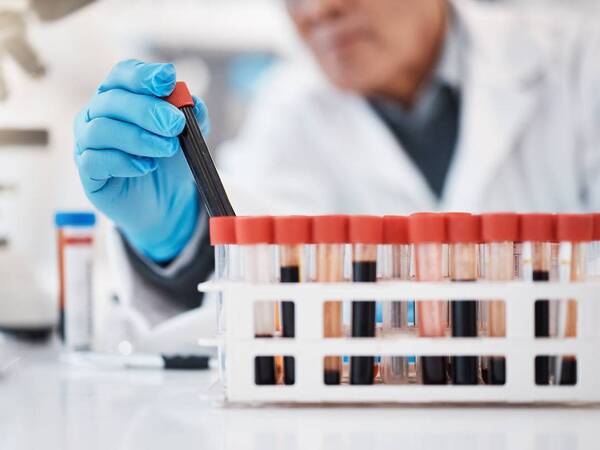 Lab Services 